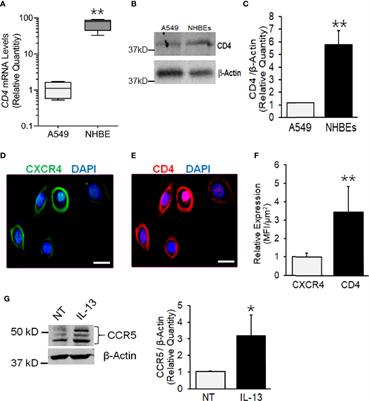 HIV-1 Productively Infects and Integrates in Bronchial Epithelial Cells